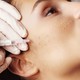 ​Векторный лифтинг лица: Эффективная подтяжка кожи без операции
